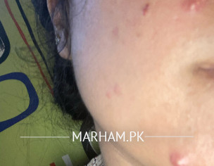 Skin Problem