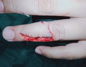 Inside Stitches