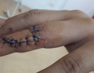 Inside Stitches