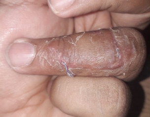 Inside Stitches