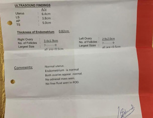 IVF Not Successful
