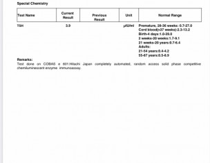 Prolactin Level
