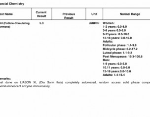Prolactin Level