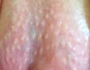 Scortium White Dots