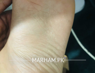 Skin Condition 