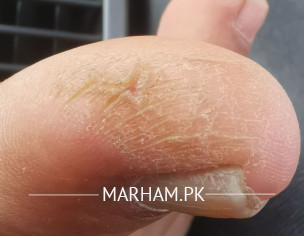 Skin Problem