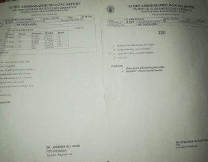 Small ASD Secundum