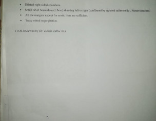 Small ASD Secundum