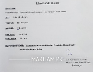Prostate/urine Problem