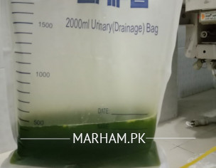 Digestive Fluid