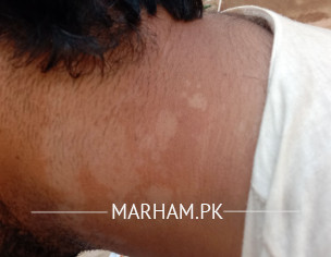 Skin Problem