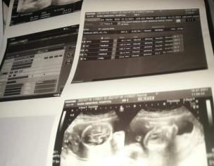 Pragnancy And Low Lying Placenta