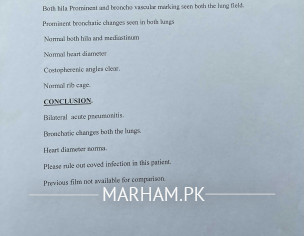 Concern About Fever 