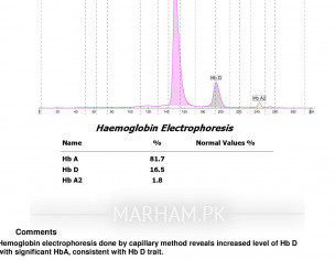 Hemoglobin Electrophoresis