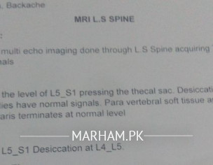 Back Pain