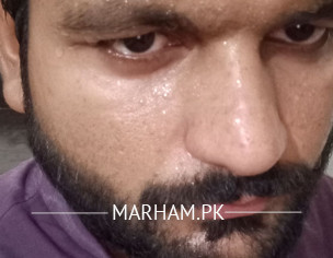 Sweating