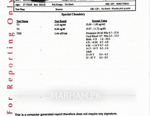 Excessive Sweating, Dizziness, Hairfall