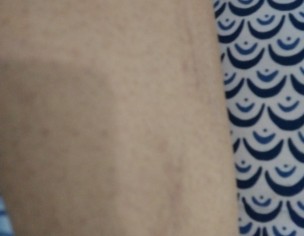 Black Patch