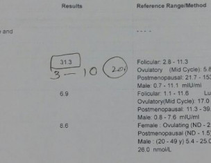 Nil Sperm Count