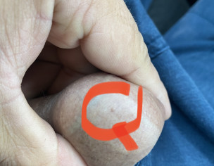 Small Bumps