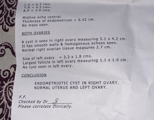 Endometiotic Cyst