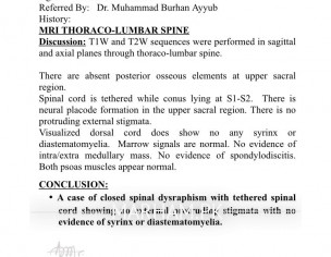 Spinal Cord