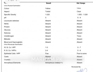 Urinalysis 
