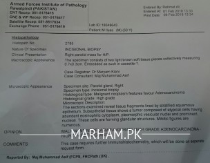 Biopsy Report