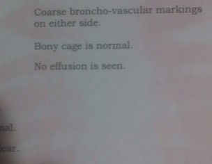 Asthma Problem