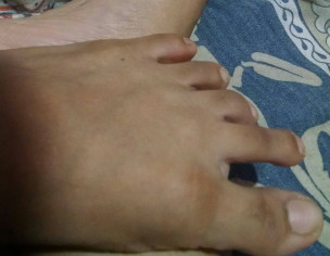 Skin Problem