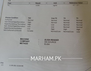 Thyroid Profile