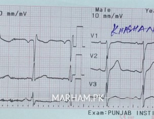 Heart Issue, Confused?