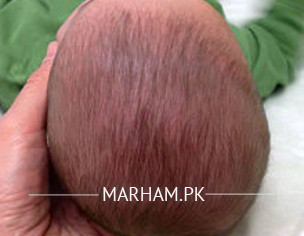 Head Shape