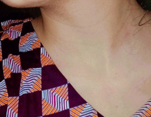 Dark Neck Problem