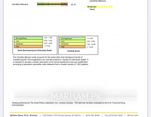 Igg Test Report 