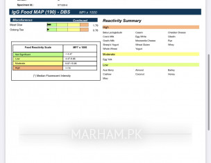 Igg Test Report 