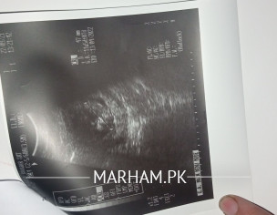 Pregnancy Placenta Problem
