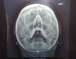 Sinus, Flu, ENT