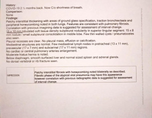 Finding EBUS Biopsy