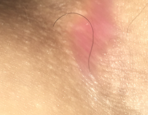 Dermatology 