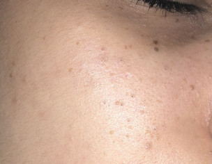 Skin Problem