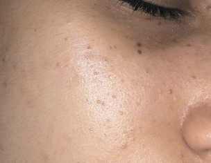 Skin Problem