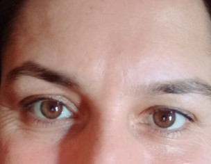 Skin Problem