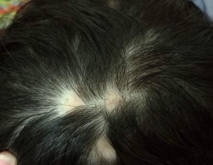 Skin/scalp