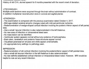 Stroke Patient 
