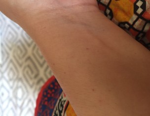 Skin Related