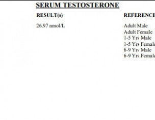 Erection Issue/ Low Libido