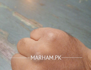 Skin Problem