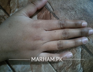 Hand Rough Issue