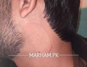 Skin Problem